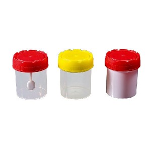 Special Design for Infusion Syringe Pump - Wholesale Price China Disposable Sterile Specimen Container, Urine Container with Yellow Cap – ORIENT